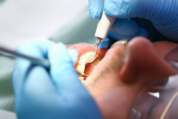 Best Emergency Root Canal Therapy in East Merrimack, NH