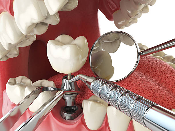 Best 24-Hour Emergency Dental Care in East Merrimack, NH